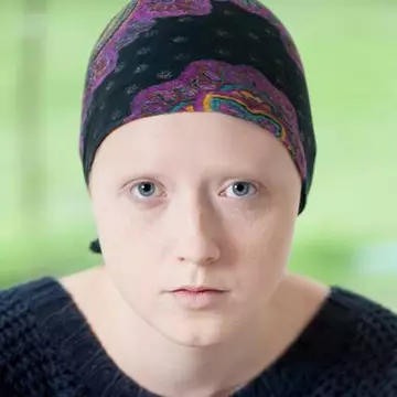 Poţi să fii bolnav şi să nu ştii. 8 semne mai puțin cunoscute ale leucemiei!