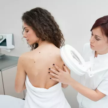Ce faci când îți rupi o aluniță
