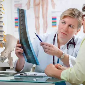 Osteoporoza poate fi prevenită!