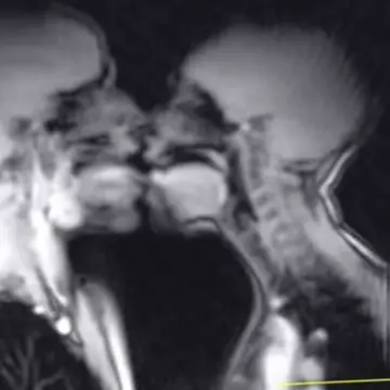 Cum arată o partidă de sex văzută la RMN! Imaginile au devenit virale | VIDEO