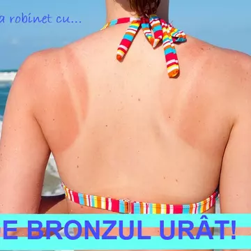 Te-ai bronzat cu pete? Corina Caragea te învață cum să rezolvi problema