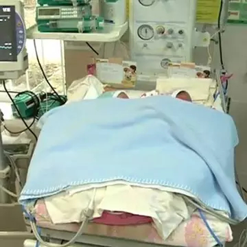 Ştia că trebuie să nască tripleţi, dar ce s-a întâmplat în sala de naşteri i-a uimit pe toţi 
