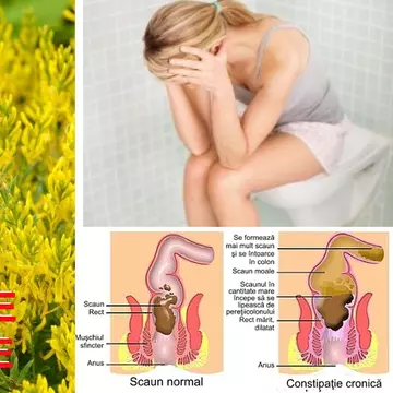 Ai probleme cu constipația în concediu? Planta care te scapă de probleme