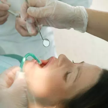 Ce se întâmplă dacă nu-ți scoți măselele de minte  