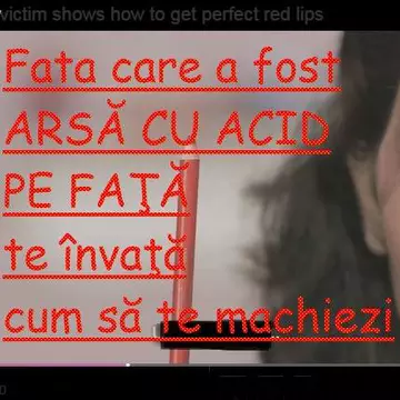 O tânără a fost mutilată de unchiul ei. Cum se machiază pentru a putea ieși din casă