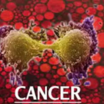 Caz incredibil în medicină! De ce a murit un bărbat de cancer, deși nu avea cancer