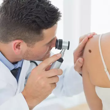 Ce tip de piele prezintă cel mai mare risc de cancer