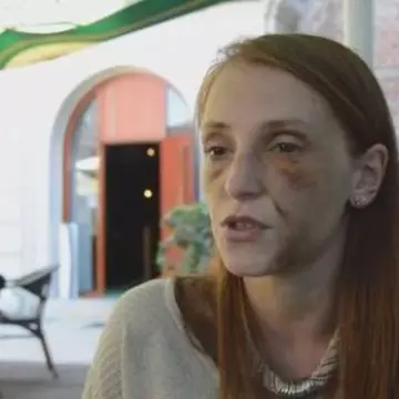 Lugojanca bătută preț de 22 de ore de iubitul gelos își tratează traumele într-un show de televiziune: ”Voi rămâne în București să trăiesc clipa!”