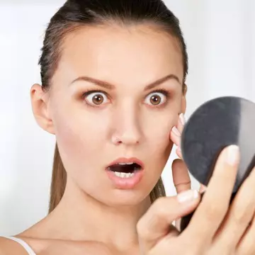 Scapă de petele pigmentare cu doar două ingrediente