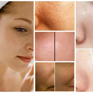 Exfoliantul minune, pentru un ten impecabil, din 3 ingrediente pe care le ai în casă