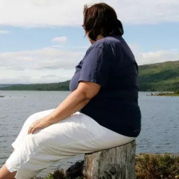 A scăpat de 90 de kilograme, dar nu și de pielea în exces. Ce poze pune pe Instagram