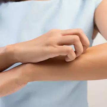Cea mai bună soluţie naturală, contra muştelor şi ţânţarilor