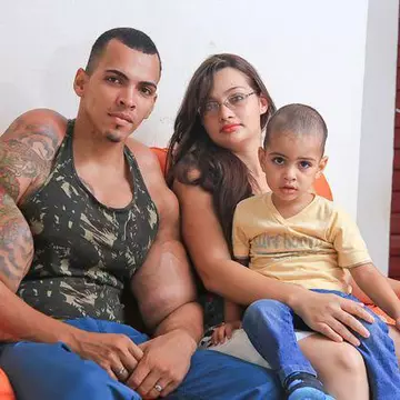 Îsi injecta muschii cu ulei sa arate ca Hulk, un viciu care îi punea în pericol viata. A renuntat însa la obsesie de dragul familiei