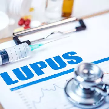 Poți să suferi de lupus și să nu ai habar. Vezi ce simptome are boala