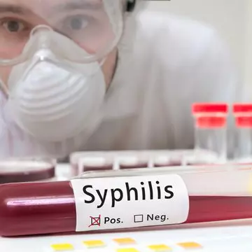 Sifilis