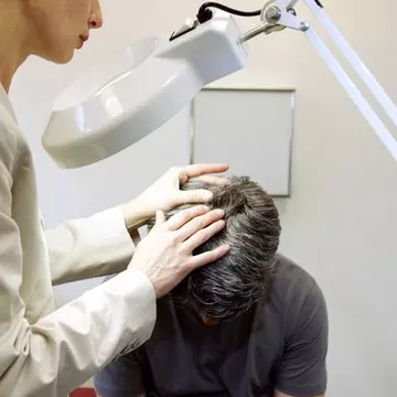 Uleiul de pește ameliorează dermatita seboreică