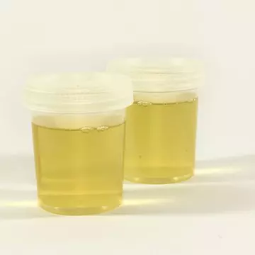 Arsura la urinare