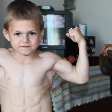 Îți mai aduci aminte de „micul Hercule”? Acum are 13 ani și arată total diferit