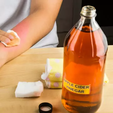 Metode naturale prin care poți scăpa de negi
