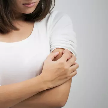 De ce te iubesc țânțarii