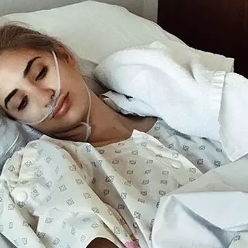 A postat o poza șocantă pentru a arăta efectele endometriozei
