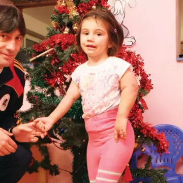 Kassandra, fetița otrăvită cu acid şi arsă cu ţigara, a făcut a 44-a operație! Cum arată acum fiica lui Iosif Rotariu