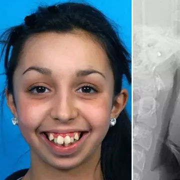 O operație dentară i-a schimbat viața