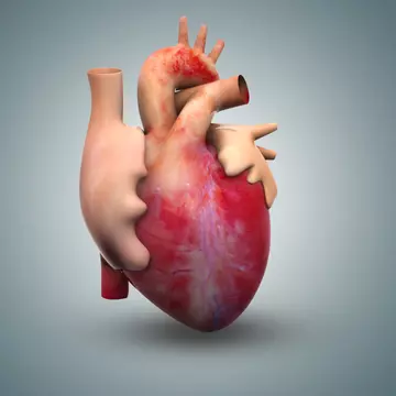 Ce este cardiopatia ischemică, boala care a ucis-o pe Cristina Stamate