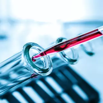 Un nou test de sânge ar putea diagnostica din timp autismul