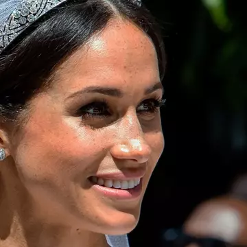 Ce intervenții estetice și-a făcut Meghan Markle