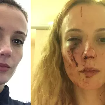 O româncă a fost bătută în Anglia de 10 adolescenți și spune că motivul ar fi rasismul