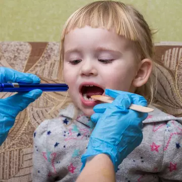 Scarlatina: simptome, mod de transmitere și tratament