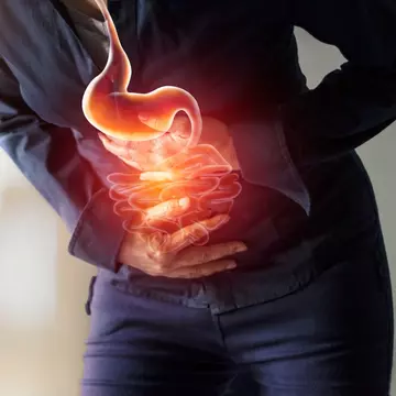Cancer de colon - simptome si factori de risc