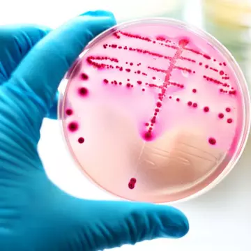 Dr Mihai Craiu, despre Stafilococul Auriu. Ce este și cum se tratează