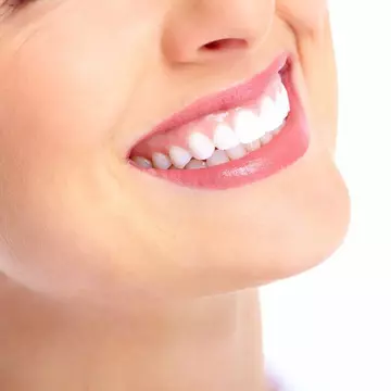 (P) Mituri despre implantul dentar