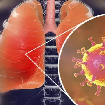 Coronavirus: Alte două cazuri au fost confirmate în România
