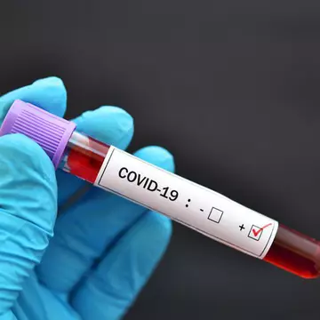 COVID-19 în România. Bilanțul oficial al cazurilor noi și al deceselor