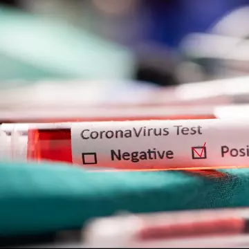 Un nou test pentru coronavirus poate să ofere rezultate în numai 2 ore