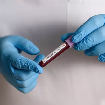 Șeful institutului german de sănătate: Epidemia de coronavirus va dura doi ani