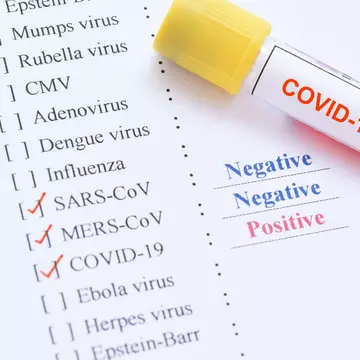 Florinela Georgescu, directorul executiv ANM, internată la Matei Balș cu coronavirus