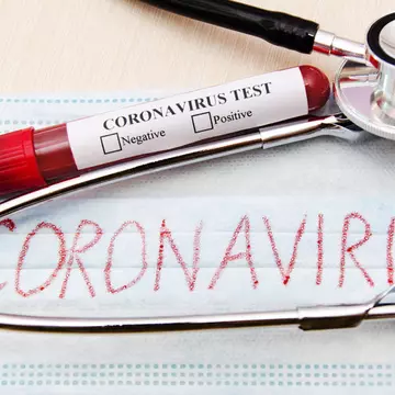 Ce se întâmpla după ce te vindeci de Covid-19. Rămâi sau nu cu sechele?