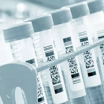Șase noi tipuri de coronavirus, descoperite de cercetători în lilieci