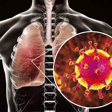 Expert: O persoană se poate infecta de mai multe ori cu coronavirus
