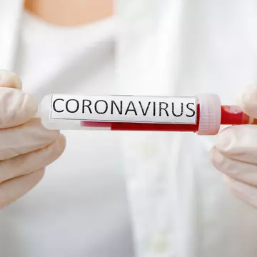 De ce mor mai mulți bărbați decât femei de Covid-19. Explicațiile medicului Mihai Craiu