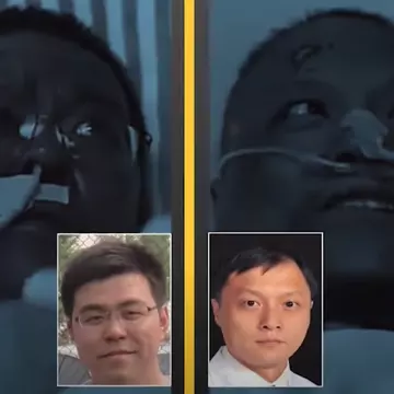 Doi medici chinezi cu Covid-19 s-au trezit din comă cu pielea neagră