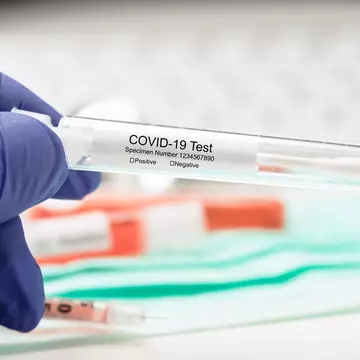 S-a lansat platforma online de testare gratis pentru COVID-19