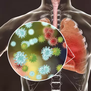 Primele focare de infecție cu noul coronavirus după măsurile de relaxare