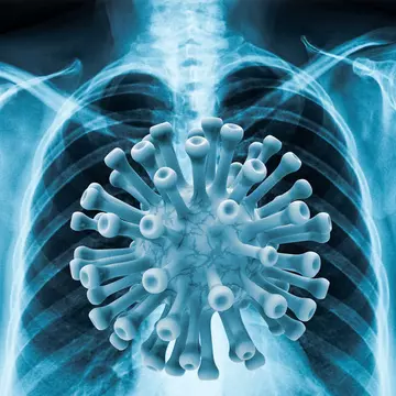 Nelu Tătaru vorbește despre posibile noi tulpini de SARS-CoV-2 în România: "Sunt câteva cazuri declarate la noi"