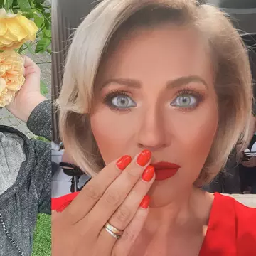 Mirela Vaida își face o intervenție chirurgicală la nivelul feței