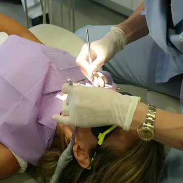 (P) Îți dorești un zâmbet cuceritor? – Descoperă câteva dintre avantajele implantului dentar